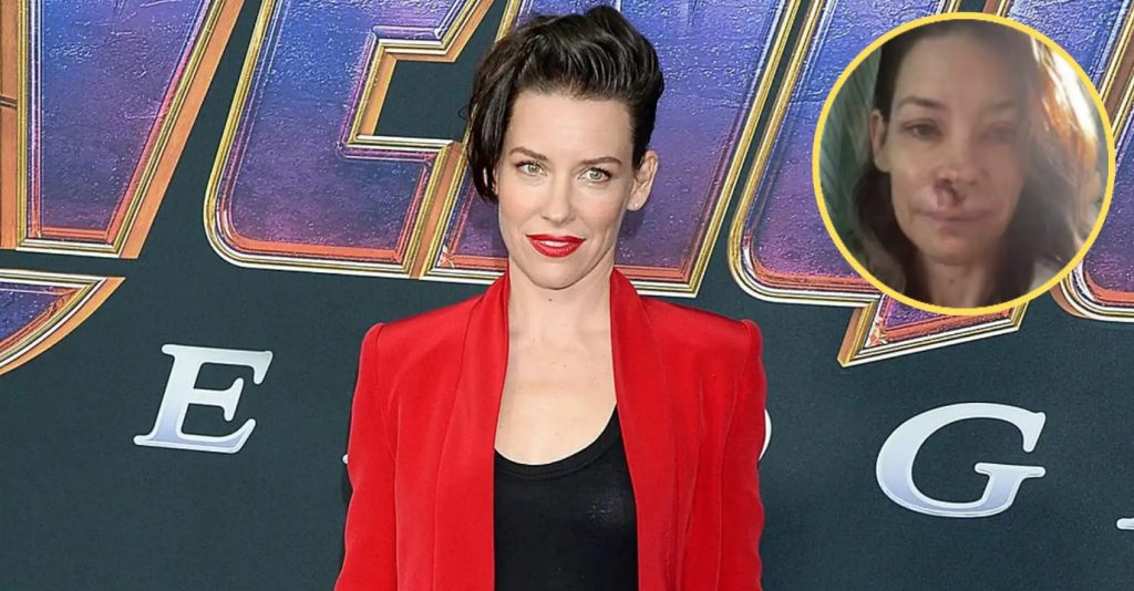 Duro golpe para Evangeline Lilly: confirmó daño cerebral tras un accidente que casi termina en tragedia