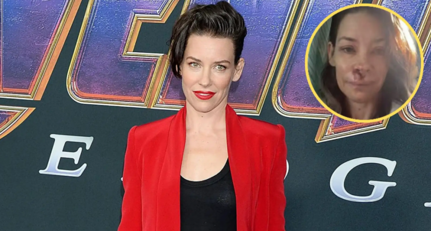 Duro golpe para Evangeline Lilly: confirmó daño cerebral tras un accidente que casi termina en tragedia
