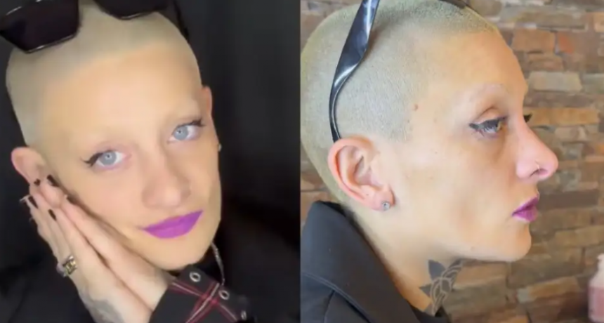 Furia de Gran Hermano dio detalles sobre el retoque estético que se realizó: 